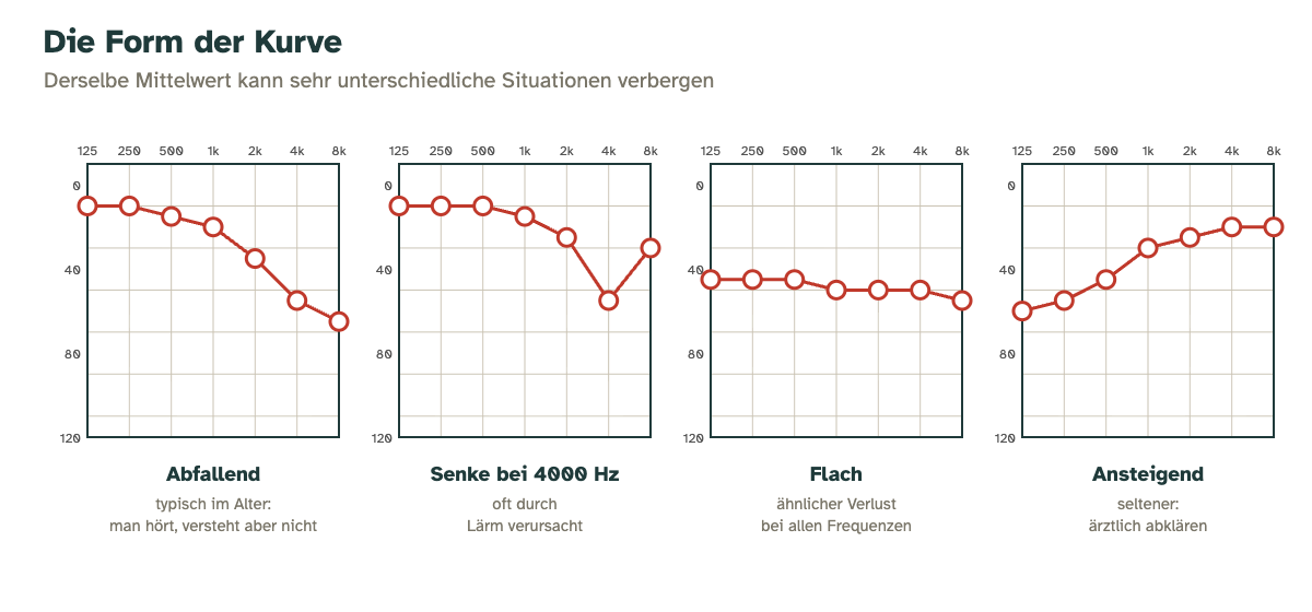 Vier typische Formen der Hörkurve: abfallend, mit Senke bei 4000 Hz, flach und ansteigend