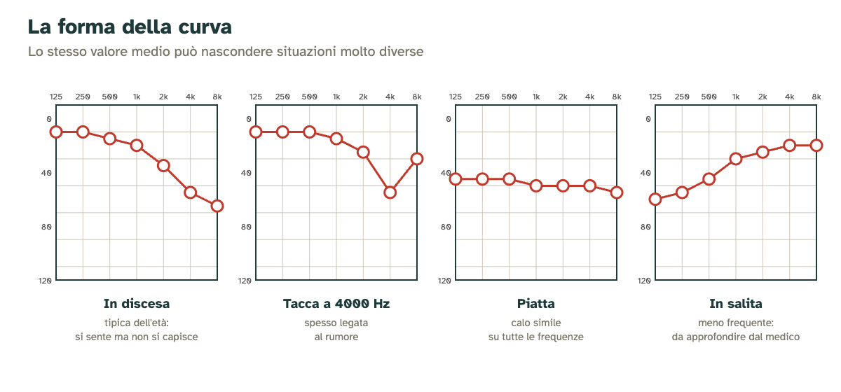 Quattro forme tipiche della curva audiometrica: in discesa, con tacca a 4000 Hz, piatta e in salita