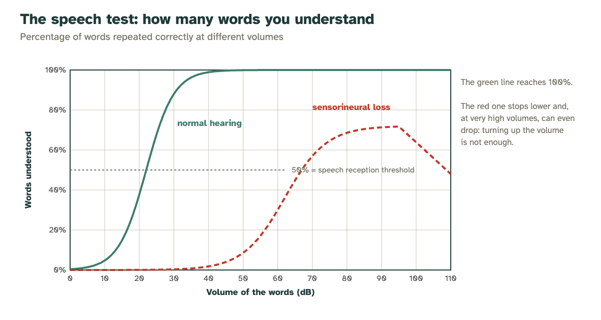 Speech test curve: with normal hearing 100% of words are understood, with sensorineural loss the curve stays lower